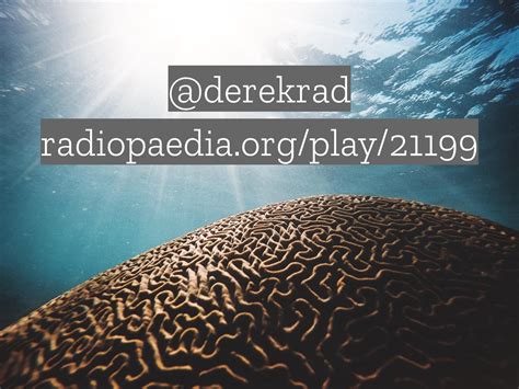 Radiology Quiz Radiopaedia Org Playlist Scotgem