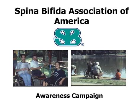 PPT Spina Bifida Association Of America PowerPoint Presentation Free