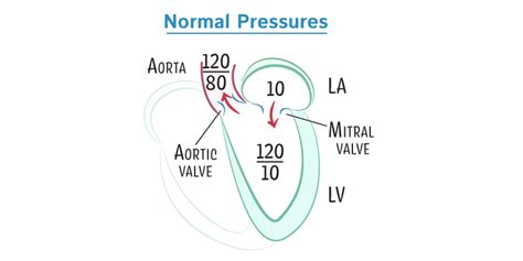 USMLE COMLEX Step 3 Glossary Heart Murmurs For USMLE Step 3