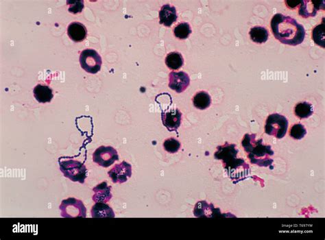 Streptokokken Fotos und Bildmaterial in hoher Auflösung Alamy