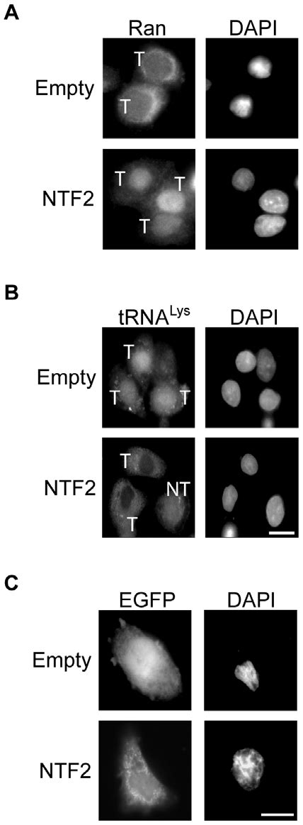 Overexpression Of Ntf Restores Nuclear Import Of Ran And Nuclear