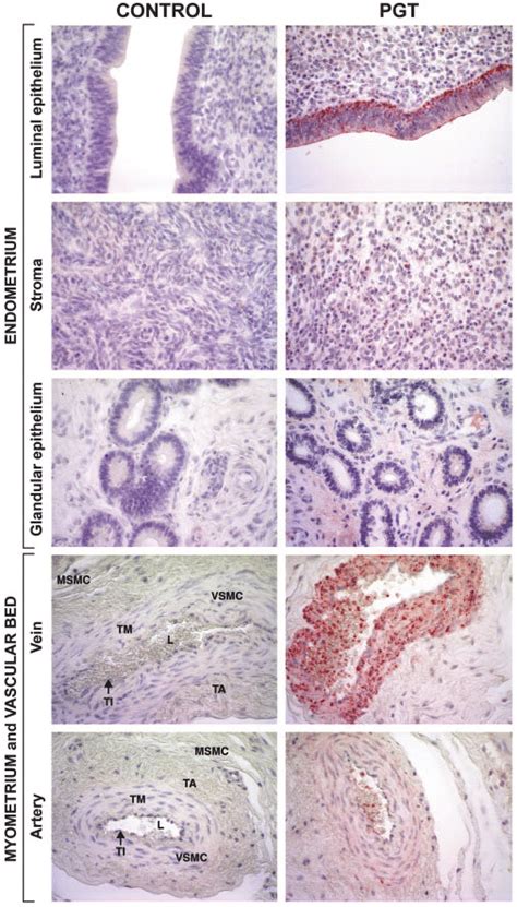 Immunohistochemical Localization Of Bpgt In Bovine Uterus On Day 16 Of