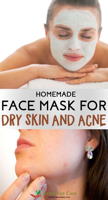 Homemade Face Mask For Dry Skin And Acne Remedies Lore