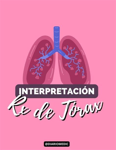 Interpretacion De Rx Torax Mishelle Chavez Udocz