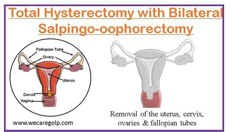 Hysterectomy Types Procedures Complications We Care