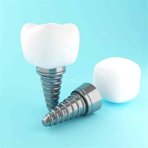 Dental Implants Turkey Reviews Prices Straumann Nobel Biocare