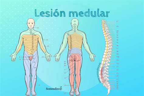 Lesi N Medular Cuales Son Sus Tipos Como Afecta Somosdisc The Best