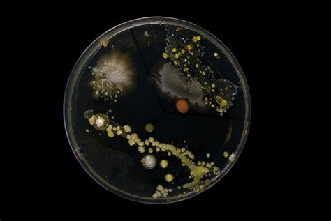 Microbiology Kit Buying Guide