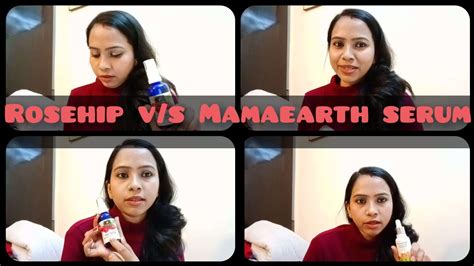 Mamaearth Skin Correct Face Serum V S Goodvibes Rosehip Serum Review