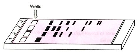 A How Do Dna Fragments Migrate And Resolve In A Gel Electrophoresis