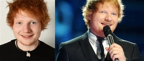 Did Ed Sheeran get eye surgery?