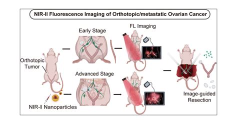 Nir Ii Fluorescence Imaging For The Detection And Resection Of