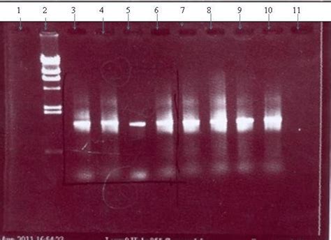 Agarose Gel Electrophoresis Picture Of Pcr Amplified Dna Showing Bands