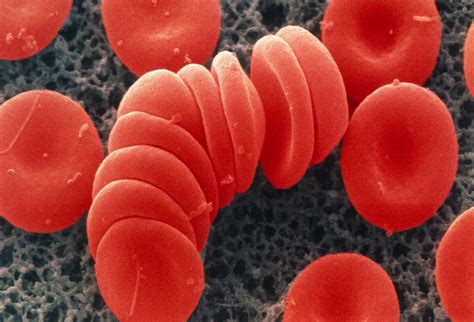 Coloured Sem Of Red Blood Cells Rouleau Formation Photograph By Power