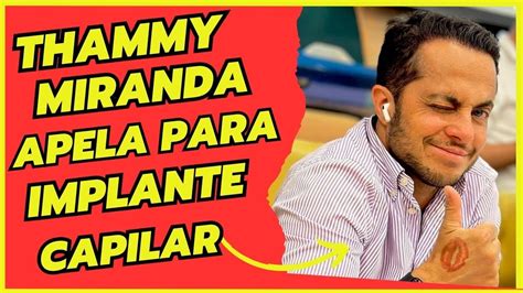 Thammy Miranda O Milagre Do Implante Capilar Youtube