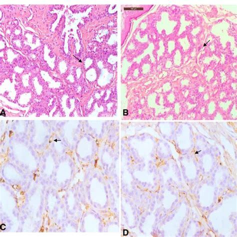 A In Mammary Gland Bar 100 μm The Stromal Connective Tissue Download Scientific Diagram