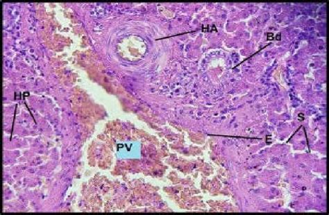 Histological Section Of The Liver In Gull Showing The Portal Triad