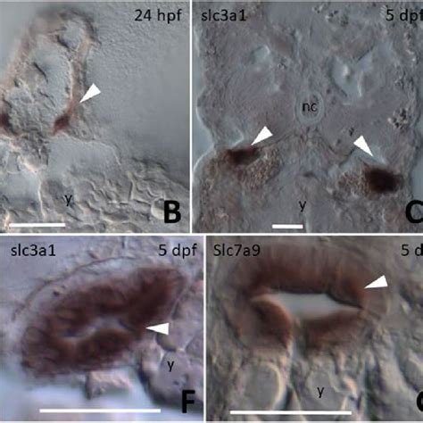 Images Of Cryo Cross Sections From Whole Mount In Situ Hybridization