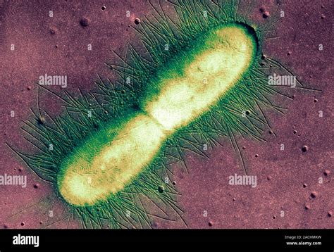 E Coli Bacterium Coloured Transmission Electron Micrograph Tem Of