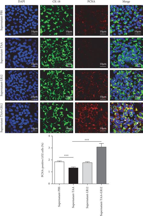 Lr Promoted Hepatocyte Proliferation Via Macrophages In Lo Cells