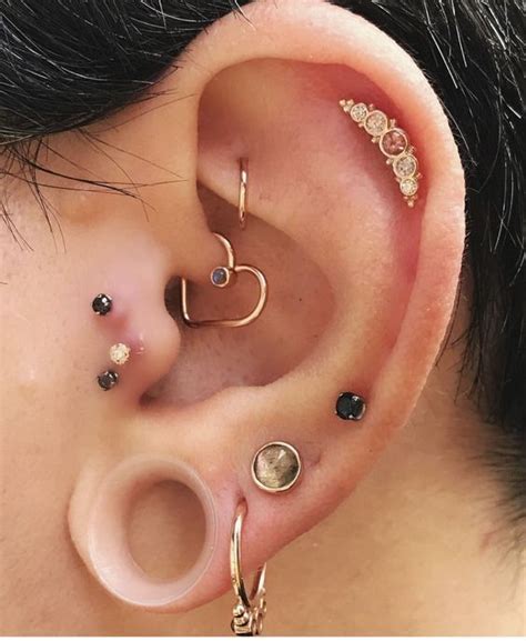 Does Ear Piercing Help Migraines