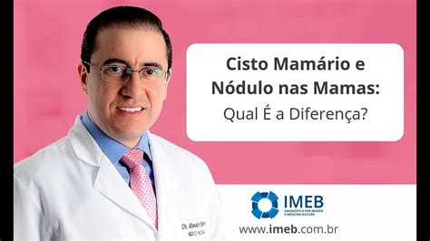 Diferença Entre Cisto Mamário e Nódulo nas Mamas IMEB YouTube