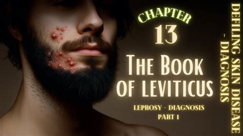 Leviticus 13 The Law For Defiling Skin Diseases Ancient Israel