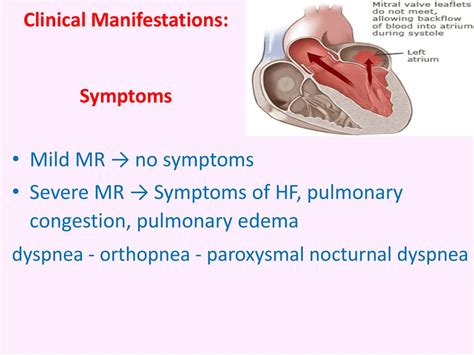 Chronic Rheumatic Heart Disease Online Presentation