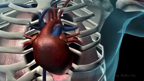 Coronary Heart Disease Animation Youtube