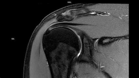 Coronal Pd Fs Dr Sharp Magnetom Lumina Siemens Healthineers Usa