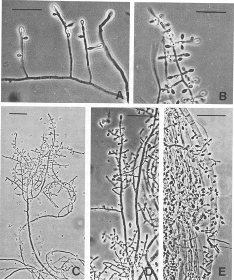 S. thermophile, phase-contrast micrographs. (A) Strain IIS 72, young ...