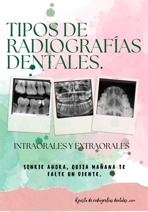 Tipos de radiografías dentales by Patricia Arce Issuu