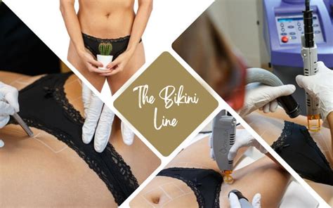 Best Laser Hair Removal For Bikini Area Discount Vivatumusica