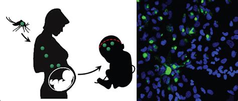 The Host Response To Zika Virus Gale Lab