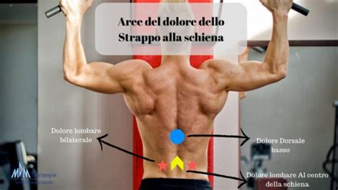 Strappo Muscolare Alla Schiena Rimedi