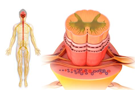 Lesión Medular Niveles causas y recuperación Neurocirugía Madrid