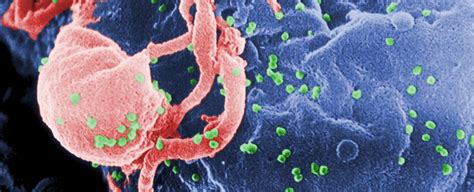What Is HIV? : ScienceAlert