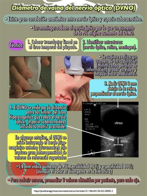 Ecograf A De La Vaina Del Nervio Ptico Yudoc Org Udocz