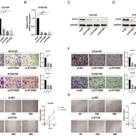 ETV5 Affects Cell Migration And Invasion In ESCC A B QPCR Indicated