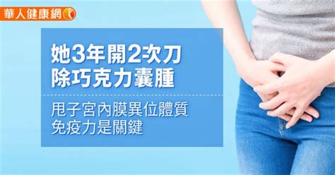 她3年開2次刀除巧克力囊腫 甩子宮內膜異位體質，免疫力是關鍵 良醫健康網