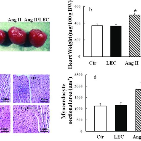 Macrophage Depletion By Lec Lowered Cardiac Hypertrophy In Ang Ii