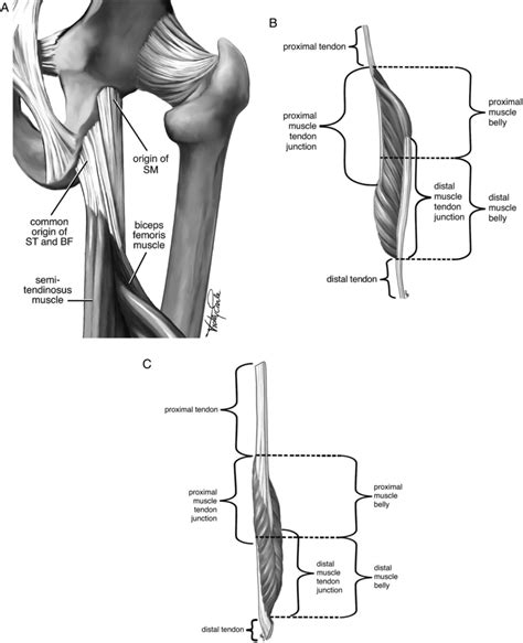 Proximal Hamstring Injury