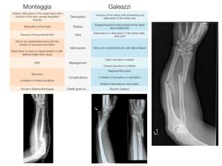 Galeazzi Fracture Classification