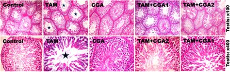 Histological Representative Photomicrographs Of Experimental Rat Testis