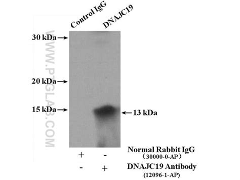 Dnajc19 Rabbit Anti Human Mouse Rat Polyclonal Proteintech 150 μl