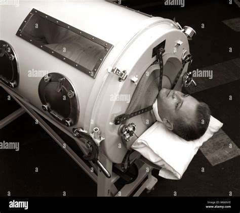 1930s 1940s 1950s MAN LYING IN IRON LUNG NEGATIVE PRESSURE VENTILATOR ...