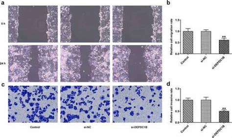 Full Article Dep Domain Containing 1b Depdc1b Exerts The Tumor