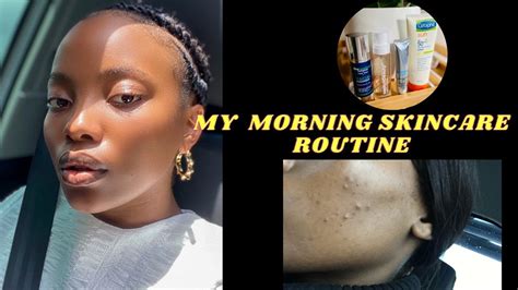 Skincare Routine How I Cleared My Acne South African Youtuber Youtube