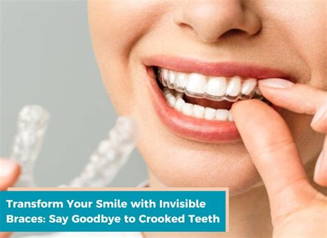 Transform Your Smile With Invisible Braces Say Goodbye To Crooked