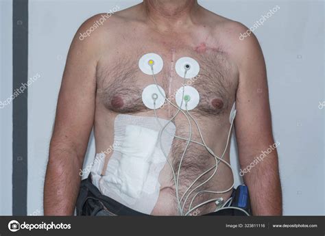 Naked Upper Body Man Electrodes Measuring Heart Tension Curve Hot Sex